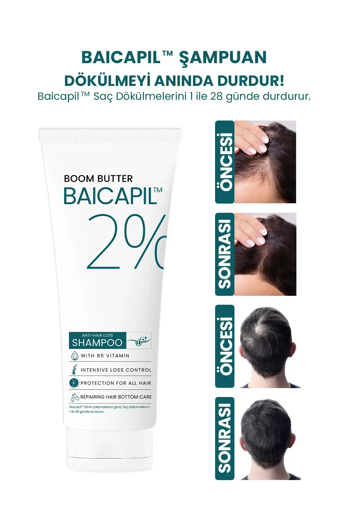 BOOM BUTTER %2 Baicapil Dökülme Önleyici ve Onarım Şampuanı 250ML - 1
