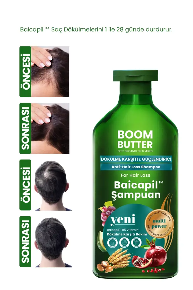 BOOM BUTTER %2 Baicapil Dökülme Önleyici ve Onarım Şampuanı 400ML - 7