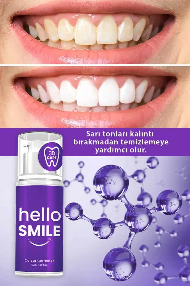 HELLO SMILE Instant Whiteness - 2
