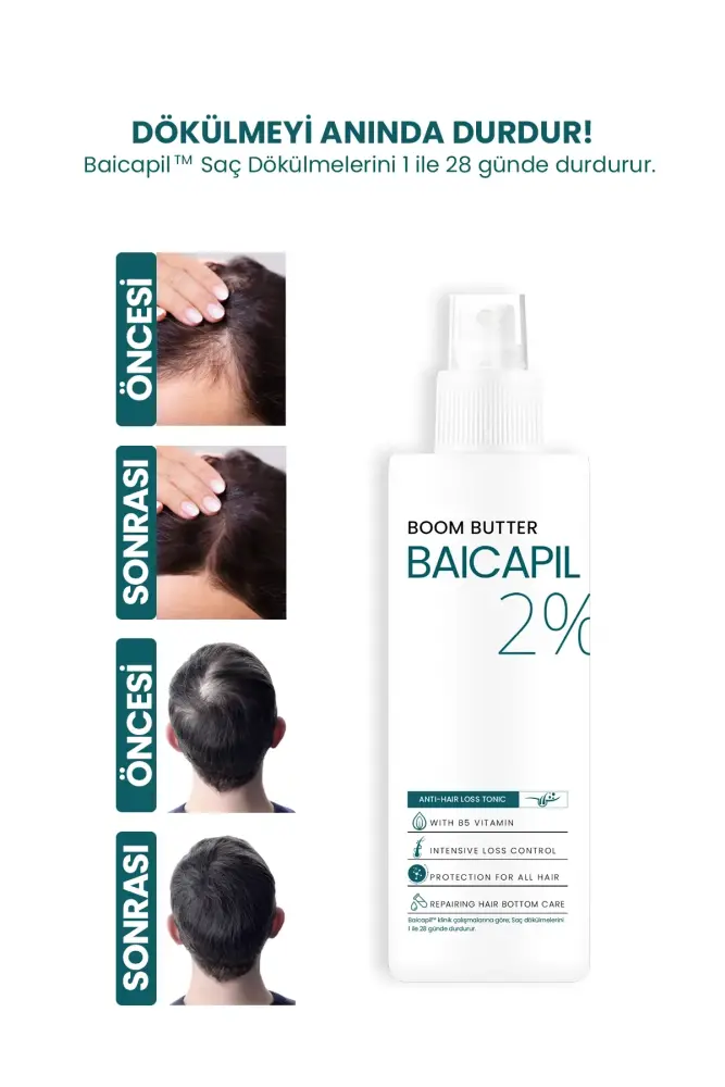 BOOM BUTTER Baicapil içerikli Dökülme Karşıtı Güçlendirici Saç Bakım Boomu 150 ML - 2